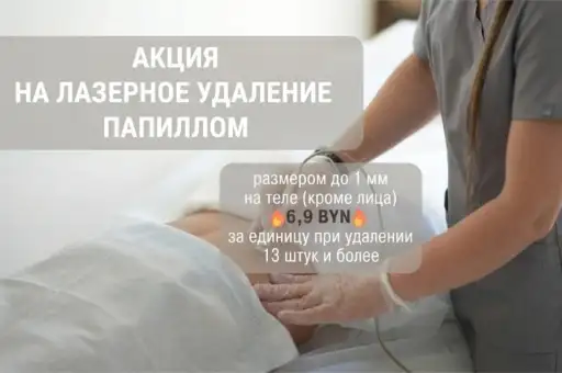 Лазерное удаление папиллом за 6,90 р./1 шт.