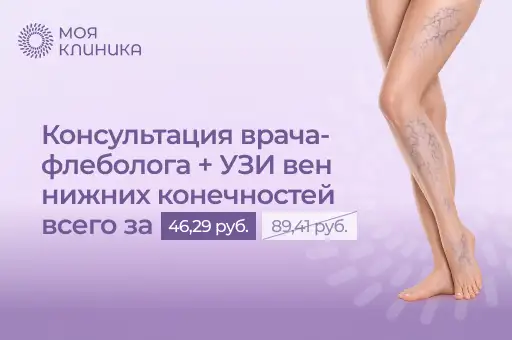 Консультация врача-флеболога + УЗИ от 46,29 руб вместо 89,41 руб